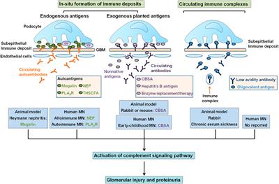 Recent Advances in Clinical Diagnosis and Pharmacotherapy Options of Membranous Nephropathy